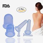 3a52521 3a Store Cupping Therapy