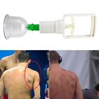 6906494894818 Unbranded Cups Set Chinese Medical Healthy Body Vacuum